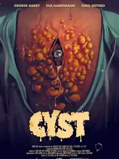 Киста / Cyst